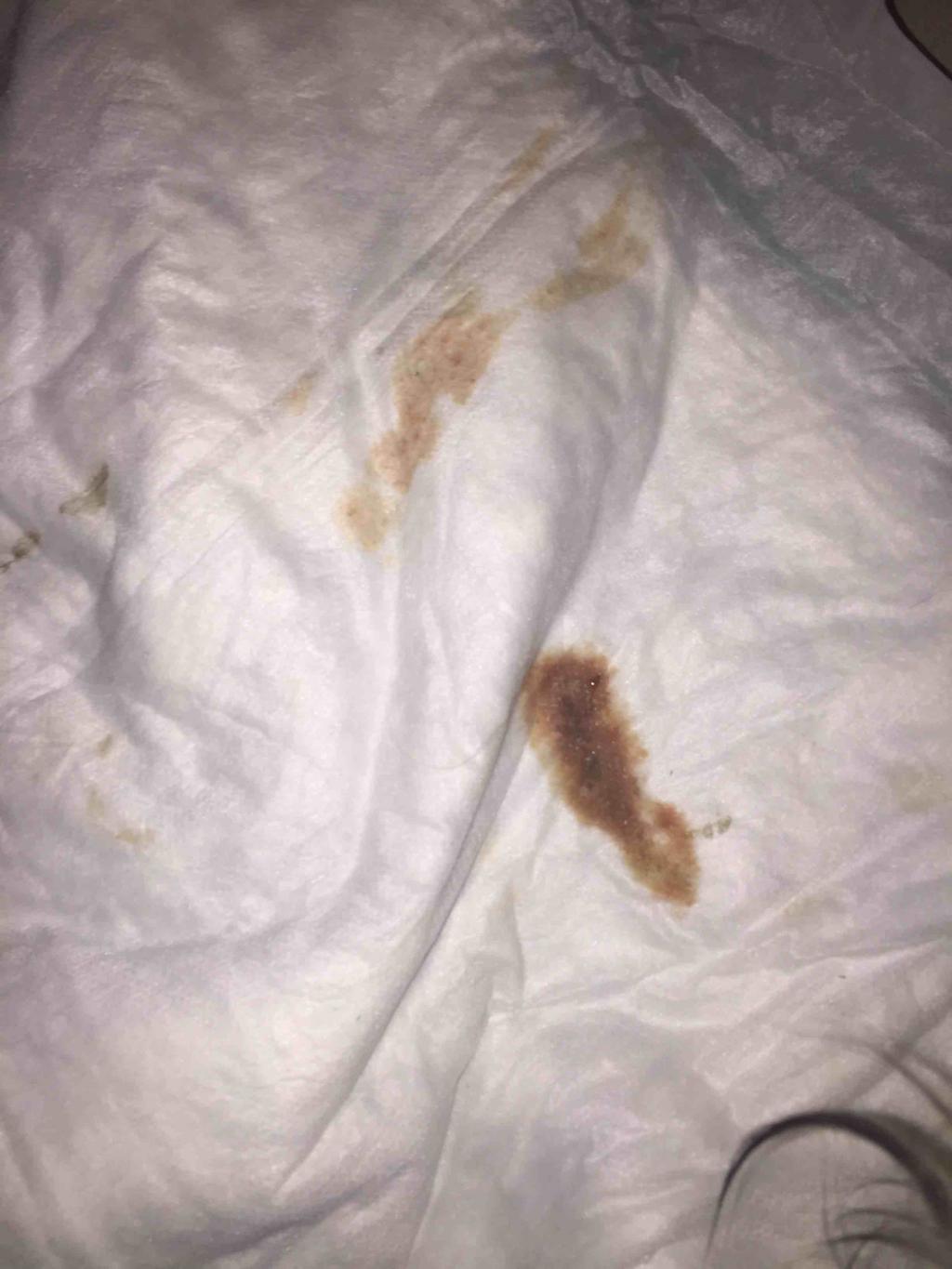 My Dog Just Discharged A Brown Looking Fluid And Is Bleeding From Her 