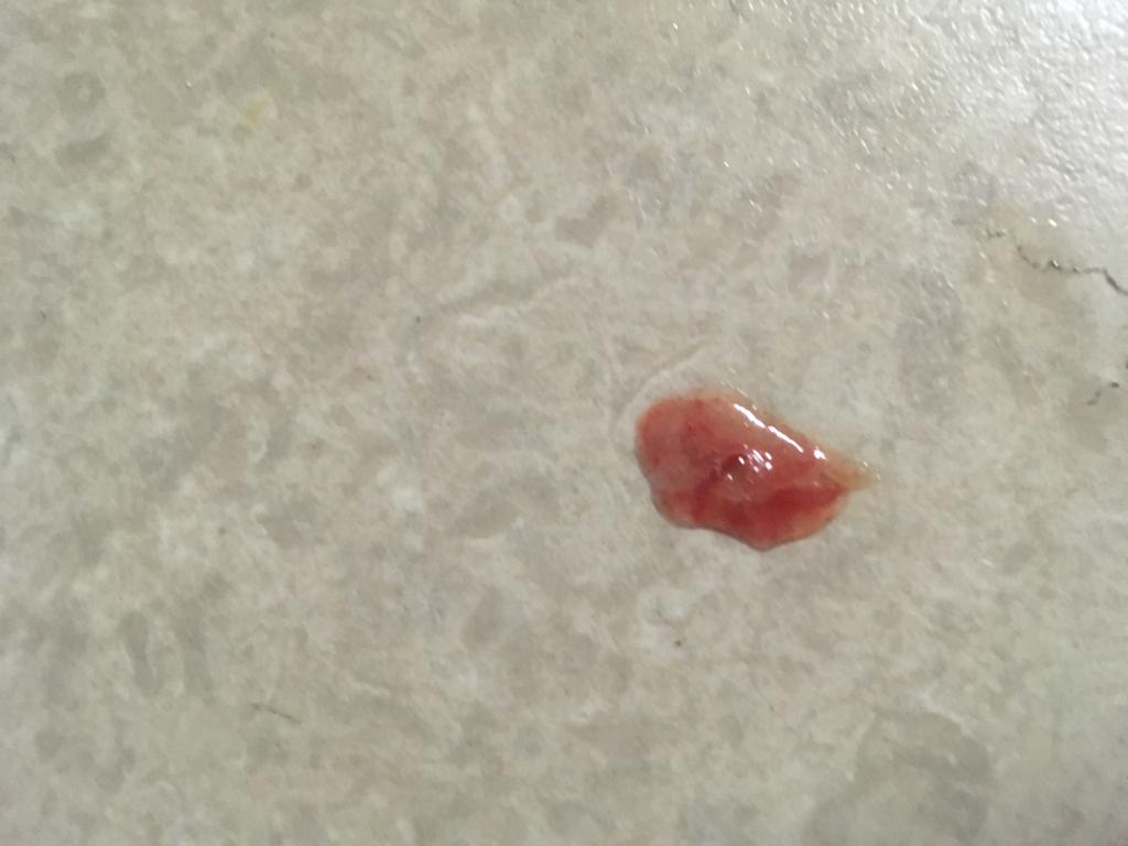 My Dog Is Coughing Up Blood And I m Not Sure What To Do Please Help 
