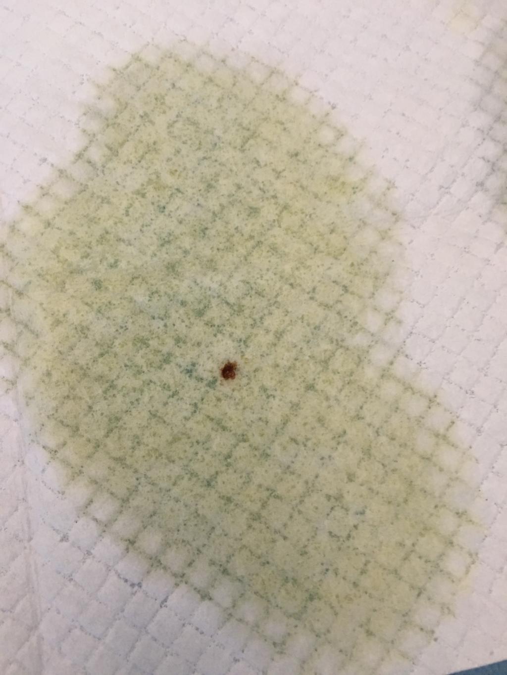 my-dog-had-heat-cycle-around-2-months-ago-but-there-has-been-blood-in