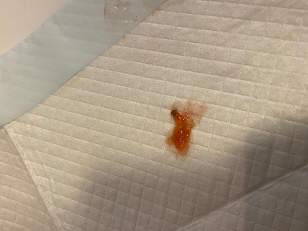 My Dog Who Has Kennel Cough Just Pooped I Think A Thick Jelly Like 