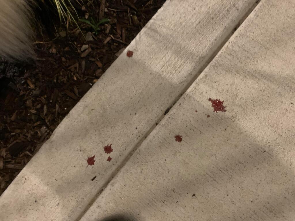 bloody-diarrhea-a-few-drops-of-bright-red-blood-after-bowel-movement